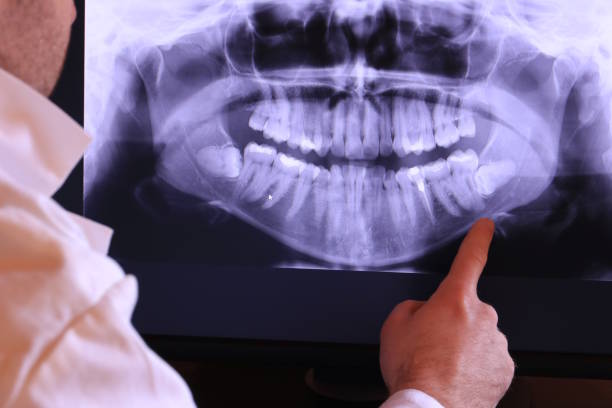 Best Cosmetic Emergency Dentistry in Lincoln, CA